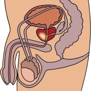 7 Prostate Orgasm Techniques That Beginners Should Know 5 an anatomic image of the prostate gland,